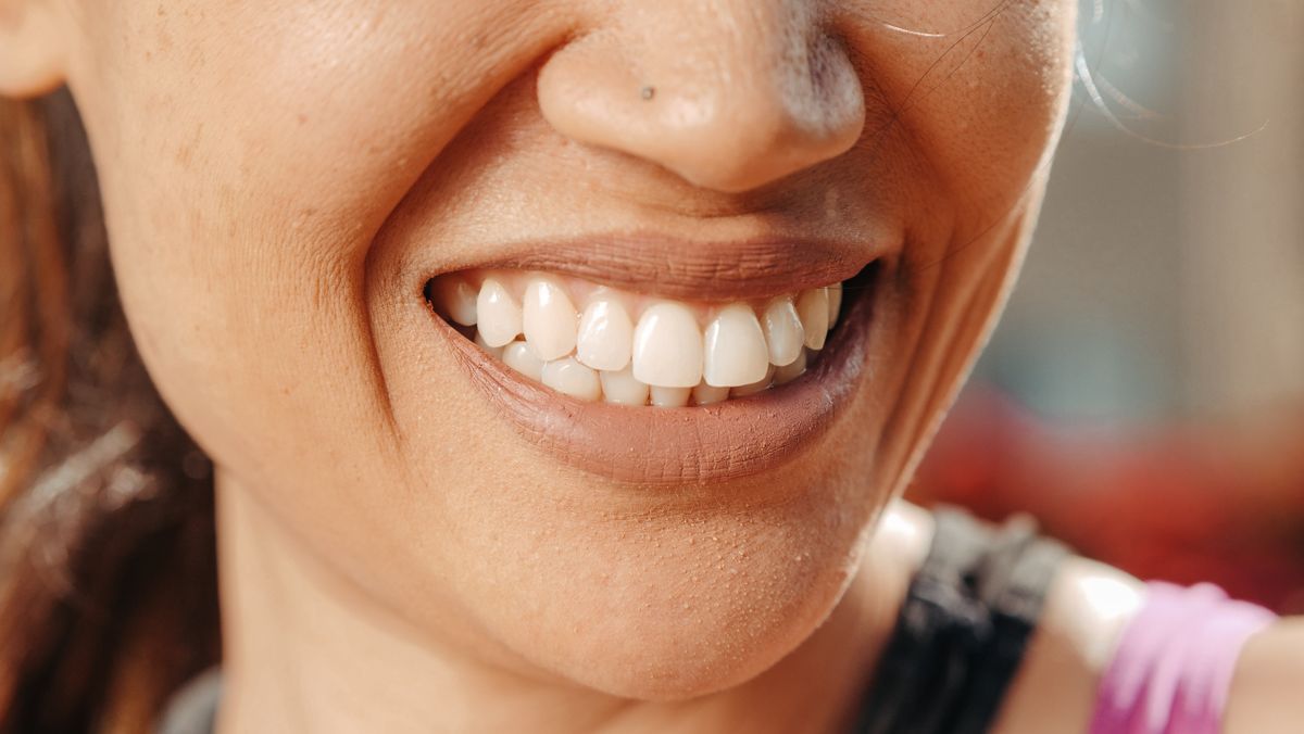 Patient smiling after care